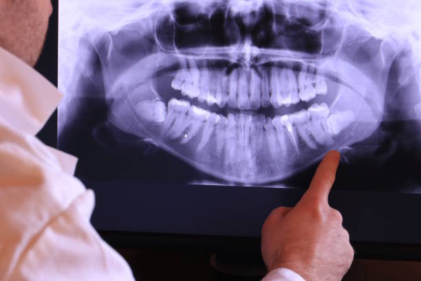 Best Emergency Broken Tooth Repair in Highland Falls, NY