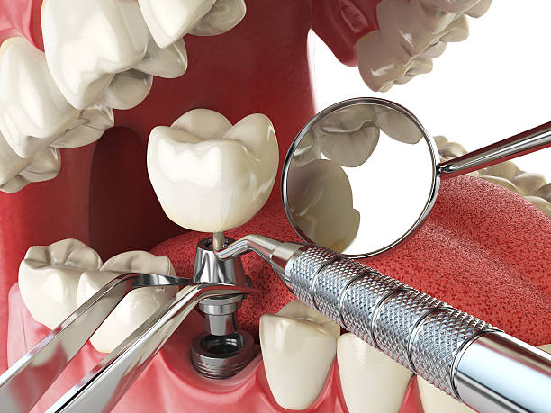 Best Emergency Orthodontic Repairs in Highland Falls, NY